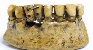 dentiera-antichi-romani