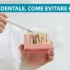 Impianto dentale: come evitare gli errori?