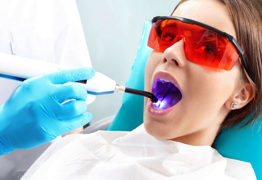 laser-dentista-non-piu-paura