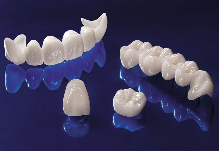 Protesi dentarie: diversi tipi per diversi problemi - Studio