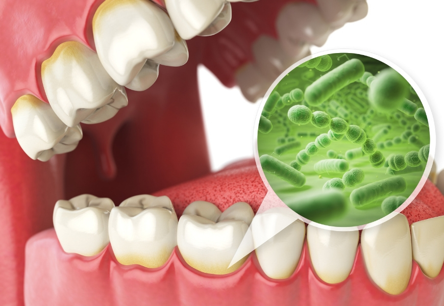antibioticoresistenza-e-salute-dentale