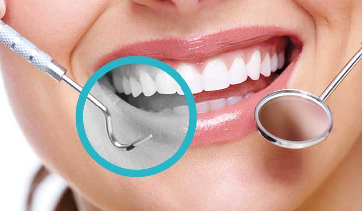 Igiene e profilassi dentale al Vomero