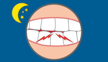  Spesso, senza accorgercene, digrigniamo i denti, soprattutto di notte. 