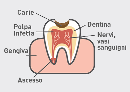 Polpa-dentale1
