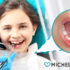 Cosa fare quando il bambino ha i denti in “doppia fila”