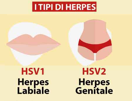 Cause-e-prevenzione-dell’Herpes-labiale