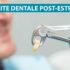 Alveolite dentale post-estrattiva