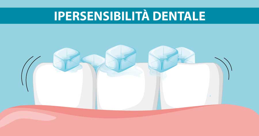 ipersensibilita-dentale-michelangelo13-napoli