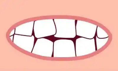 denti storti michelangelo 13 dentista vomero