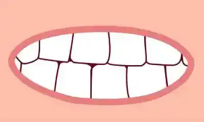 https://www.dentistavomero.it/odontoiatria-pediatrica-al-vomero