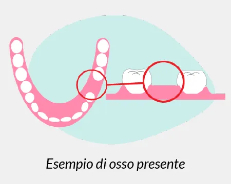 esempio di osso presente